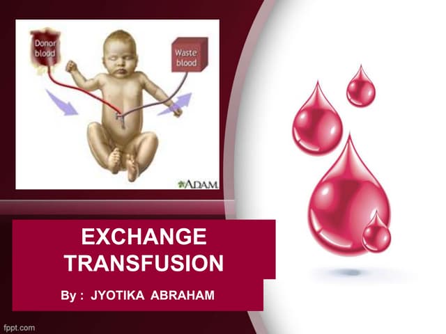 Exchange transfusion - series—Procedure: MedlinePlus Medical Encyclopedia