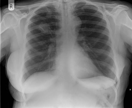 Annular Lesions: Diagnosis and Treatment